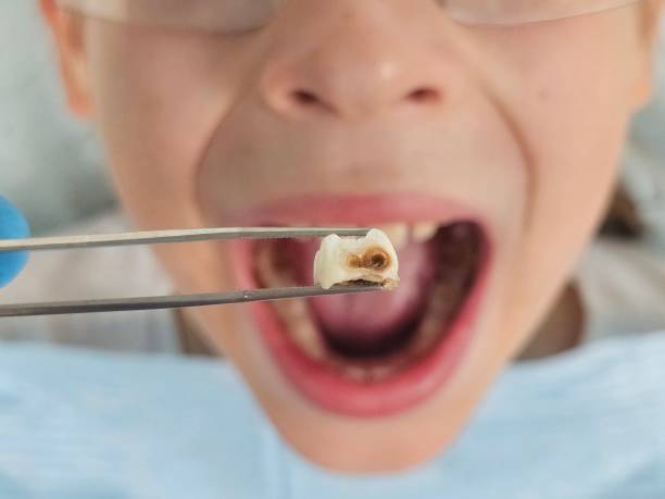 Best Emergency Gum Pain Relief  in Exton, PA